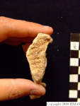 L_V20d5087 A16.31 R827 lR ta left pubic symphysis 